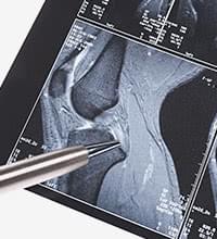 メリット1.再生医療の適応を事前に確認できる