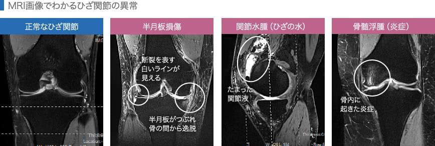 実際のMRI画像